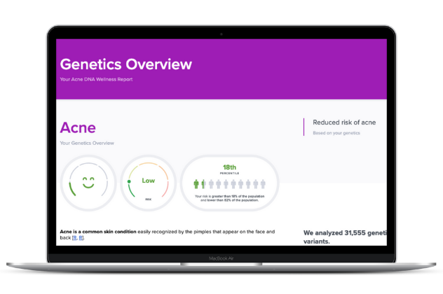 Is acne genetic DNA report