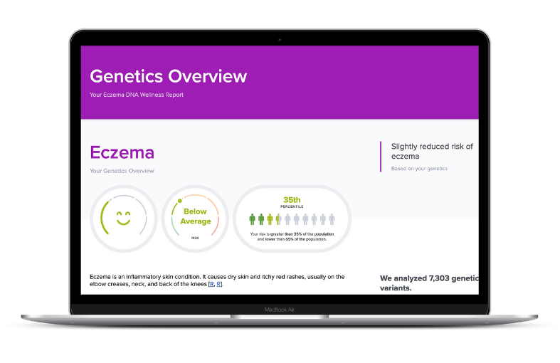 Is eczema genetic DNA report